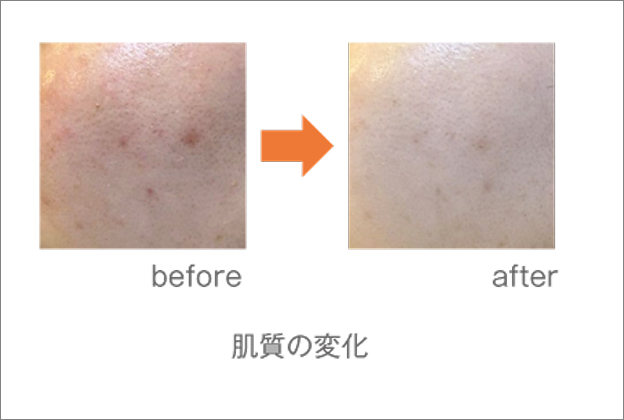 ウルトラファインバブル生成装置